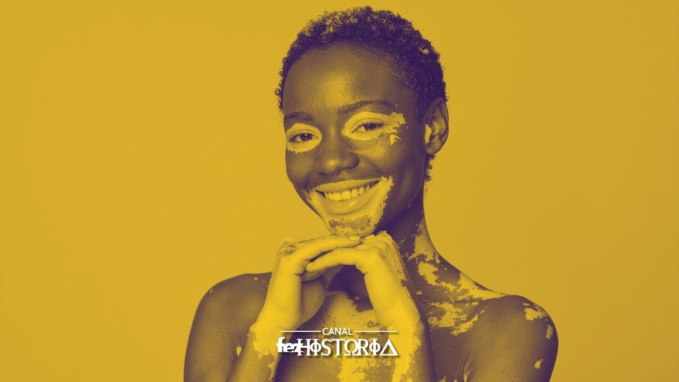 Dia Nacional dos Portadores de Vitiligo